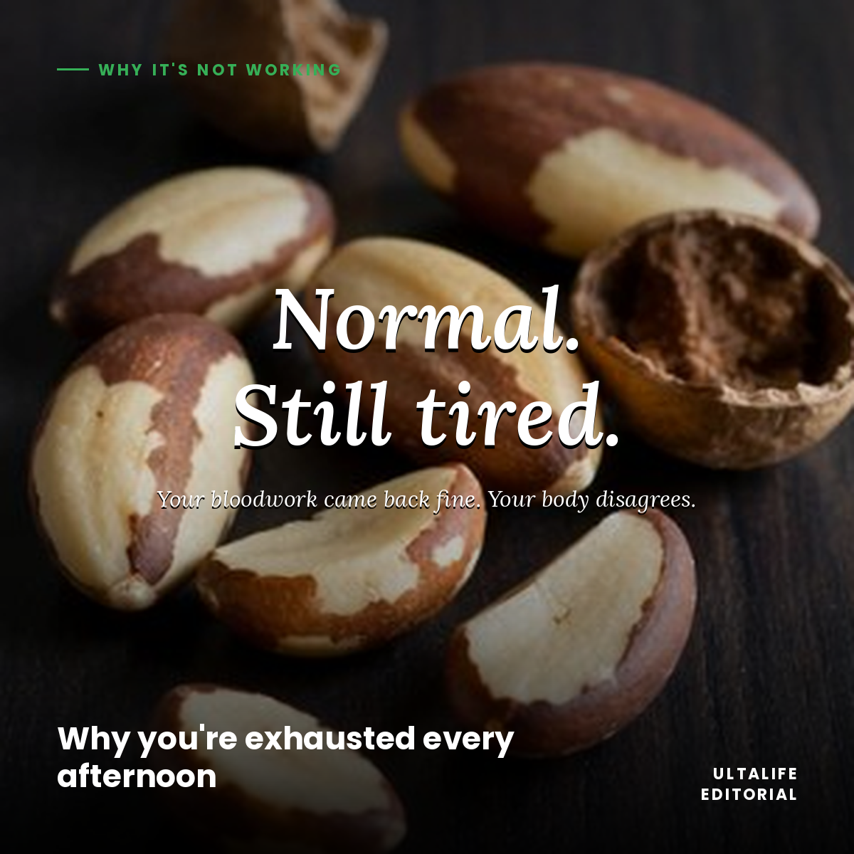 Why you're exhausted every afternoon and no one can tell you why